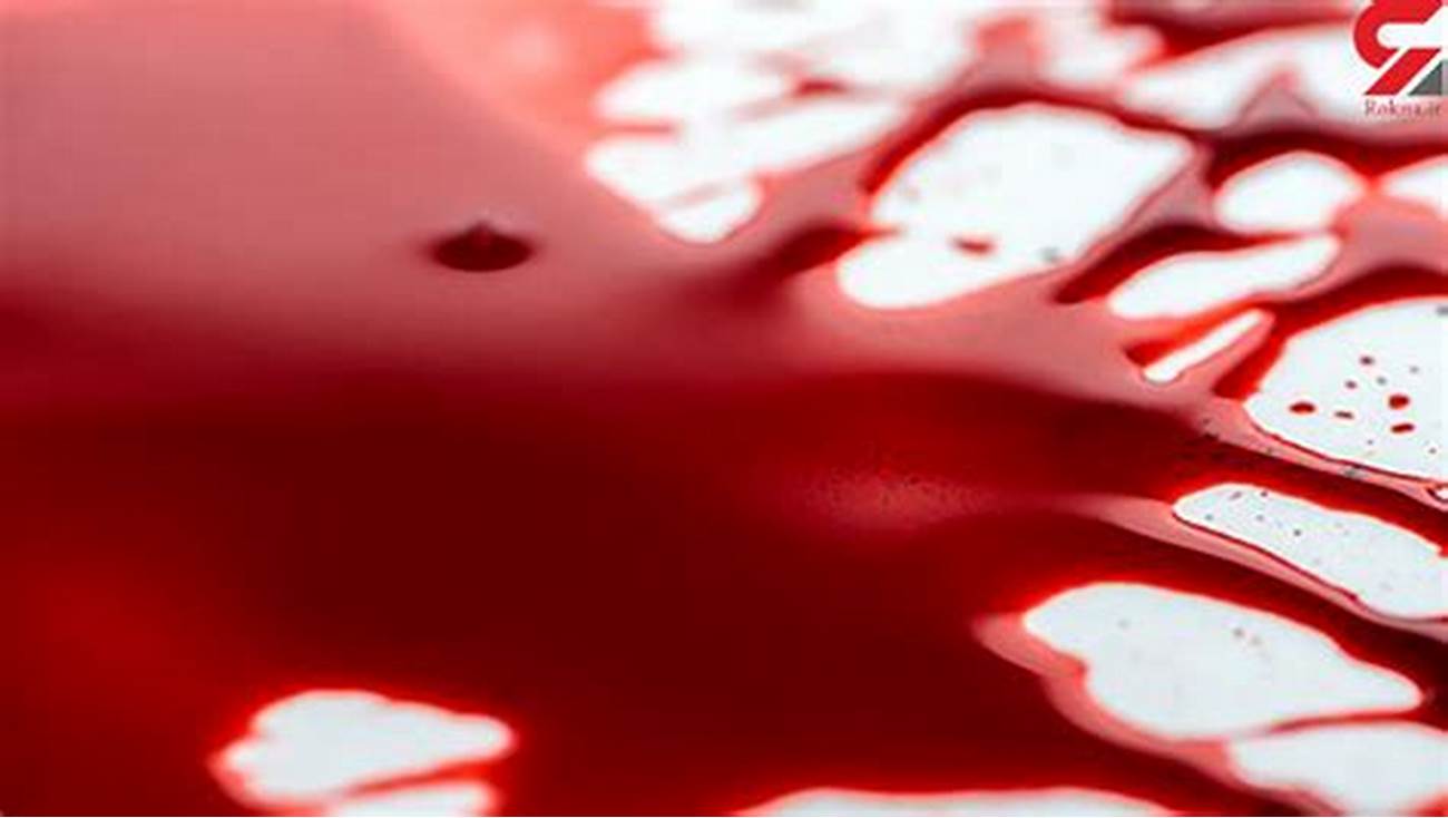 m&aacute;u chảy nhiều